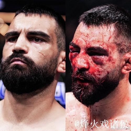 马纳里诺无情出击，瓦林卡满场飞奔疲于应对，四蛋无辜受虐